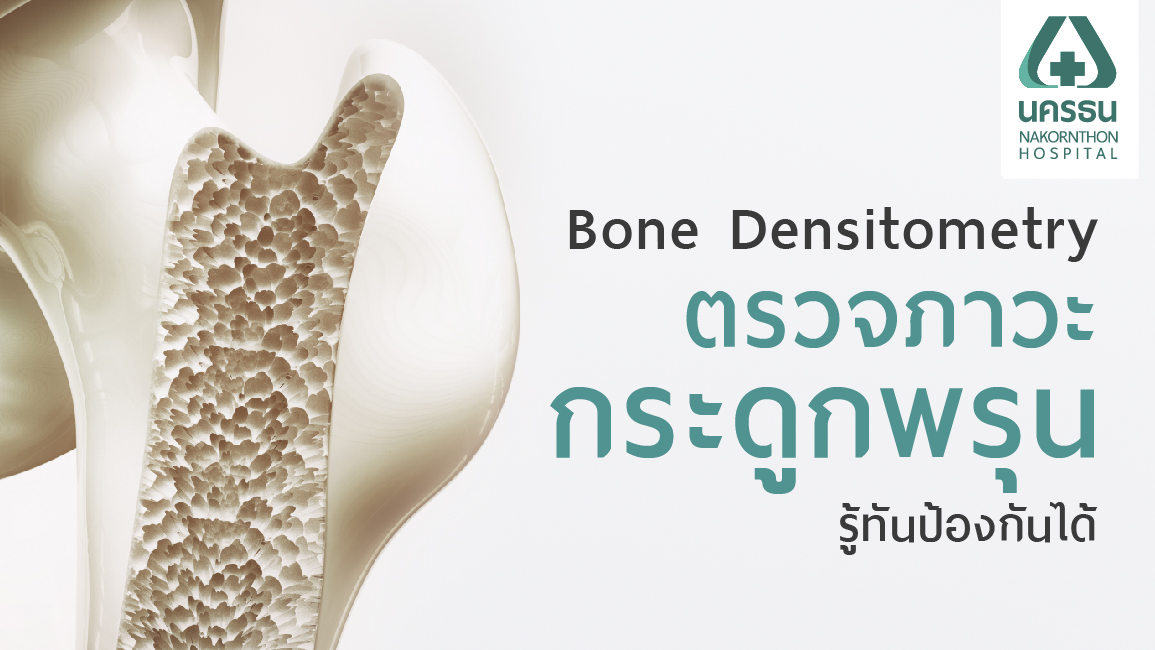 กระดูกพรุนรู้ก่อน ป้องกันได้ รักษาเร็ว ด้วยการตรวจ Bone Densitometry